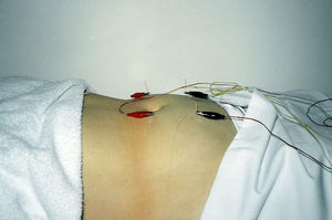 Treatment of Obesity